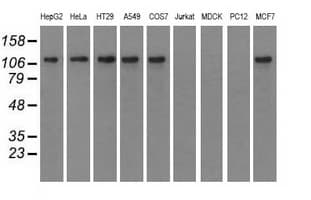 ERIC-1 / TACC3 Antibody (clone OTI1E8)