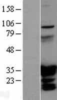 HOXC6 Protein (Over-Expression Lysate Myc-DDK (Flag))