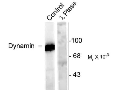 DNM1 / Dynamin Antibody (phospho-Ser778)