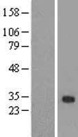 ZFAND2B Protein (Over-Expression Lysate Myc-DDK (Flag))