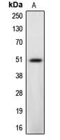 CASP12 / Caspase 12 Antibody (Internal)