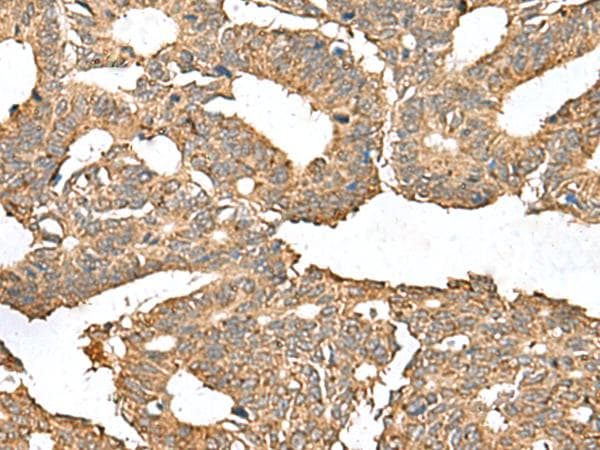 Polyclonal Rabbit anti-Human AHNAK Antibody (IHC)