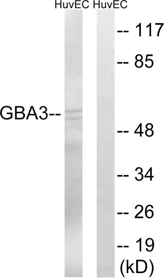 GBA3 / CBG Antibody (aa291-340)