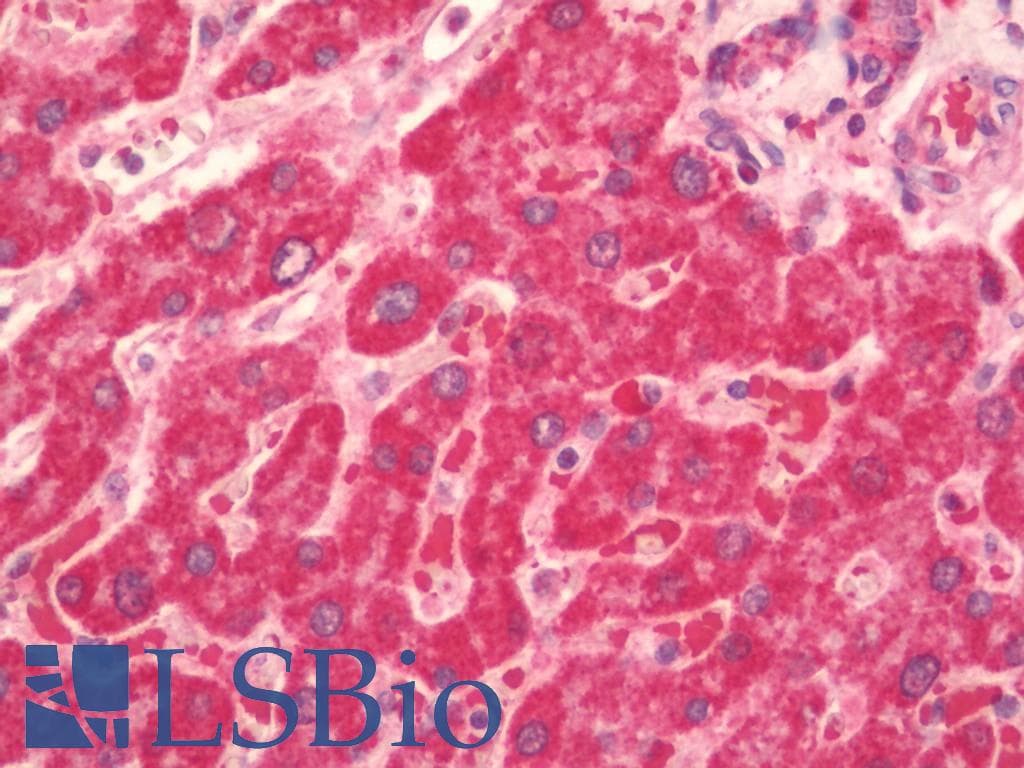 IHC-plus™ PS20 / WFDC1 Antibody (aa148-177)