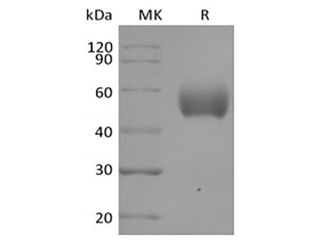 Human SIRPA / CD172a Protein (Recombinant 6His, C-terminus)