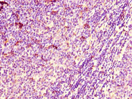 ARIH2 Antibody