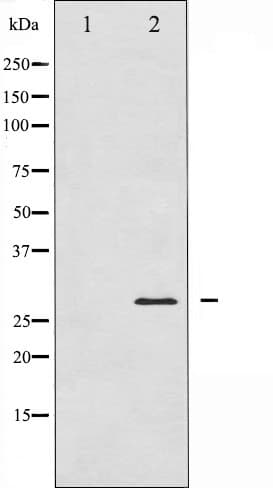 TNNI3 / Cardiac Troponin I Antibody