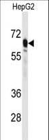 PCK2 / PEPCK Antibody (aa24-54)