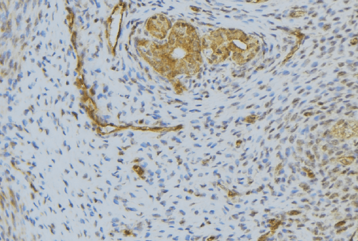 HGF / Hepatocyte Growth Factor Antibody