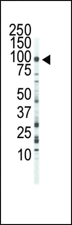 FGFR3 Antibody (aa776-806)