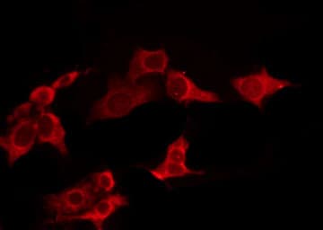 Polyclonal Rabbit anti-Human TAS2R7 / T2R7 Antibody (IF, WB)