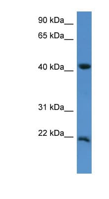 Polyclonal Rabbit anti-Human IMMP2L Antibody (C-Terminus, WB)