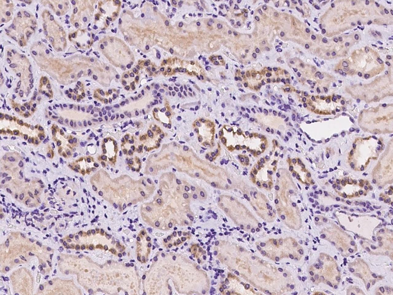 Polyclonal Rabbit anti-Human TM4SF1 Antibody (IHC)