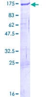 Human ZFYVE28 Protein (Recombinant GST)