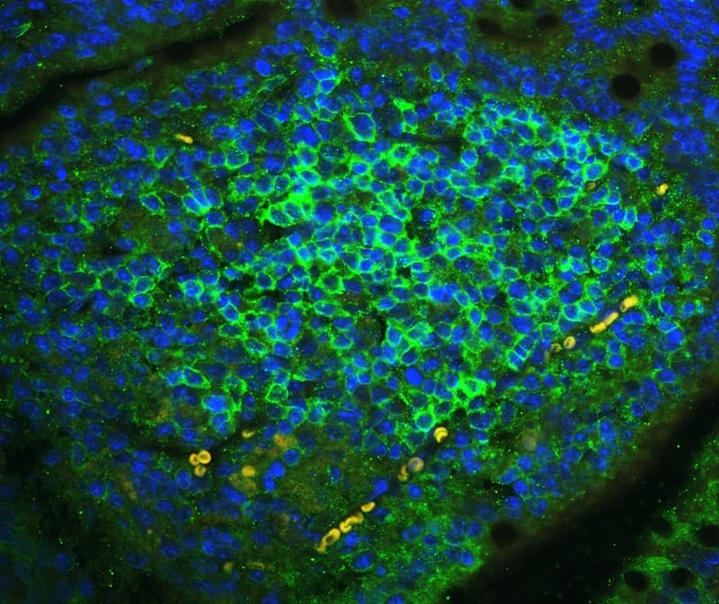 FCER2 / CD23 Antibody (aa50-331)