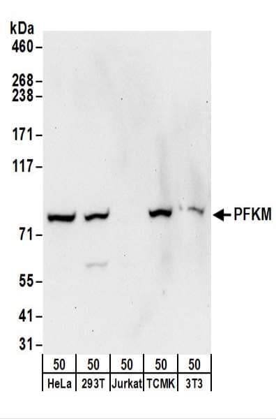 PFKM / PFK-1 Antibody (aa1-50)