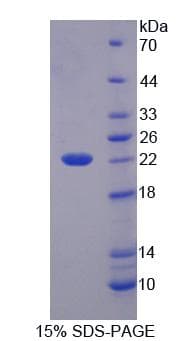 Mouse HADH Protein (Recombinant)
