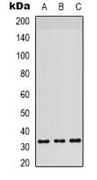 RPS6 / Ribosomal Protein S6 Antibody (C-Terminus)