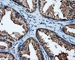 APP / Beta Amyloid Precursor Antibody (clone OTI7G9)