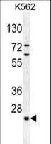 C15orf41 Antibody (aa167-193)