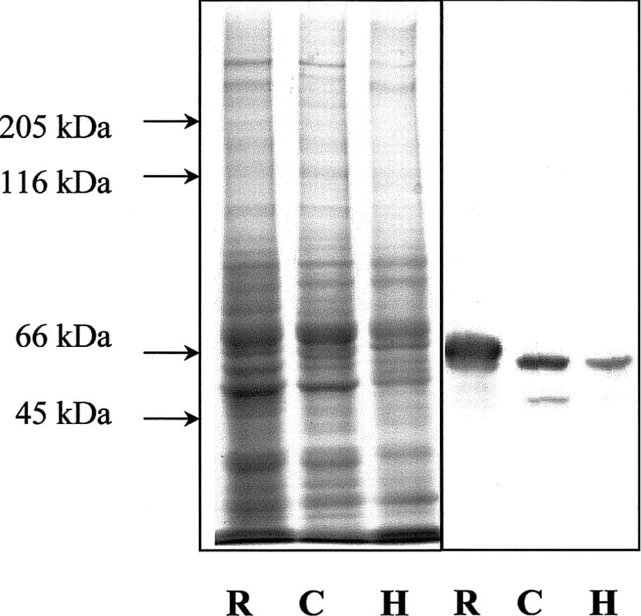 INA / Alpha Internexin Antibody (clone 1D2)