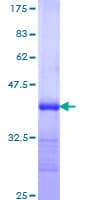 Human PACE4 / PCSK6 Protein (Recombinant GST, N-terminus)