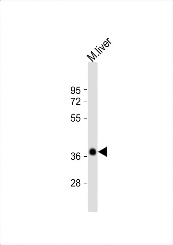 PIG8 / EI24 Antibody (aa27-61)