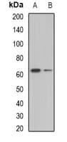 BTD / Biotinidase Antibody (Biotin)