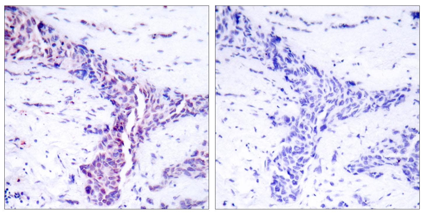 Polyclonal Rabbit anti-Human ATF2 Antibody (p73 or 55, IHC, IF, WB)