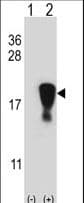 SNRPD1 / SMD1 Antibody (aa69-98)