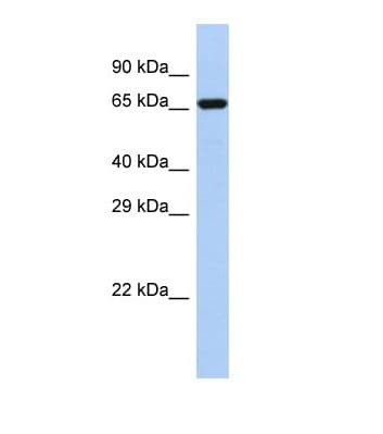 BARD1 Antibody (aa574-623)