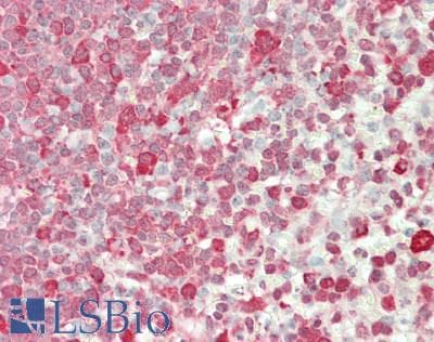 IHC-plus™ RPS14 / Ribosomal Protein S14 Antibody (aa101-151)