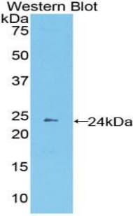 PCDHB2 / Protocadherin Beta 2 Antibody (aa79-253, FITC)