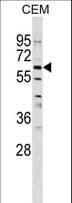 Polyclonal Rabbit anti-Human GPNMB / Osteoactivin Antibody (aa541-569, WB)