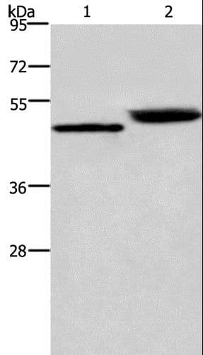 CTSE / Cathepsin E Antibody