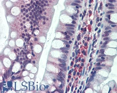 IHC-plus™ RREB1 Antibody (aa1375-1425)