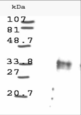 Polyclonal Rabbit anti-Human CCND1 / Cyclin D1 Antibody (WB)