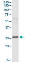 PSPH Antibody (clone 3A5)