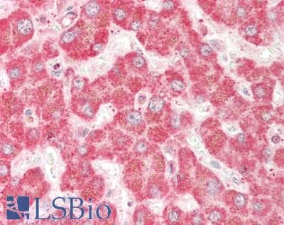 IHC-plus™ ACOT8 Antibody (aa131-180)
