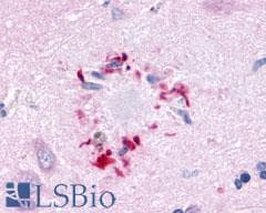 PathPlus™ GPR78 Antibody (Cytoplasmic Domain)