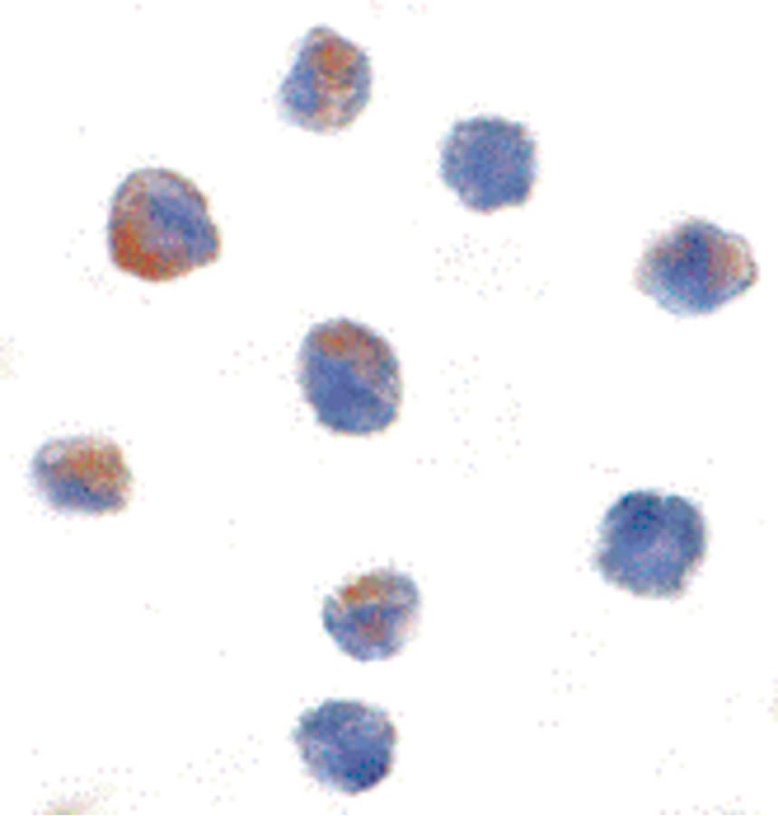 IHC-plus™ CUL9 / Cullin 9 Antibody