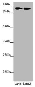 HK3 / Hexokinase 3 Antibody