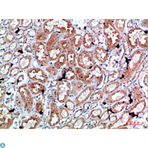 PRF1 / Perforin Antibody