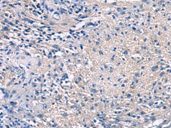 PROKR2/Prokineticin Receptor 2 Antibody