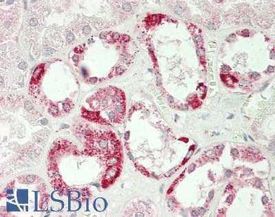 Polyclonal Rabbit anti-Human MECOM / EVI1 Antibody (aa964-1013, IHC, WB)