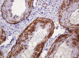 PADI4 / PAD4 Antibody (clone OTI5C10)