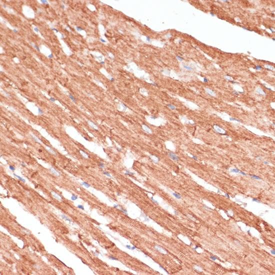 DES / Desmin Antibody