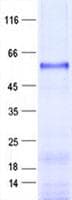 Human ZBTB26 Protein (Recombinant His, N-Terminal)