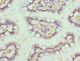 Polyclonal Rabbit anti-Human NMU / Neuromedin U Antibody (IHC, WB)