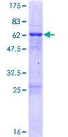 Human JAZF1 Protein (Recombinant GST)